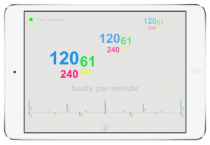 beat detector | dsp mobile